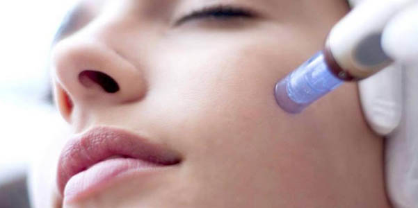 MICROneedling-EN-BOGOTA